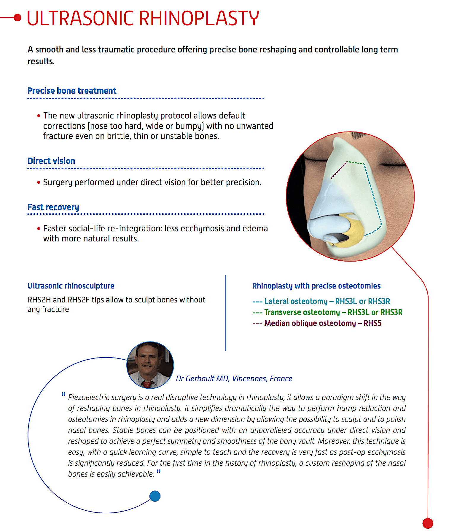 piezo rhinoplasty piezo rhinoplasty
